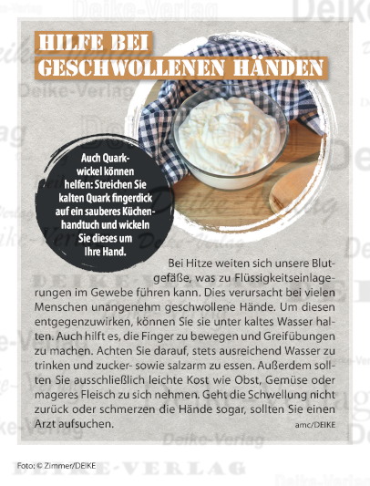 Hilfe bei geschwollenen Händen